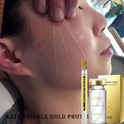 Collagen Thread Instant Lifting Wrinkle Remover Soluble Protein Thread Serum Set Absorbable Face Filler Anti-aging Skin Care New