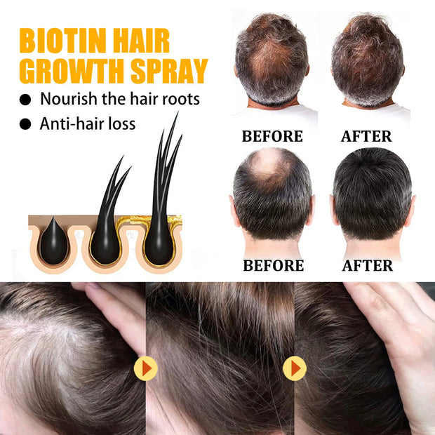 Biotin Hair Care Spray Nourish Scalp Hair Follicle Reduce Hair Loss Stabilizer Hair Root Refresh Oil Control Natural Plant Essence