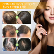 Biotin Hair Care Spray Nourish Scalp Hair Follicle Reduce Hair Loss Stabilizer Hair Root Refresh Oil Control Natural Plant Essence